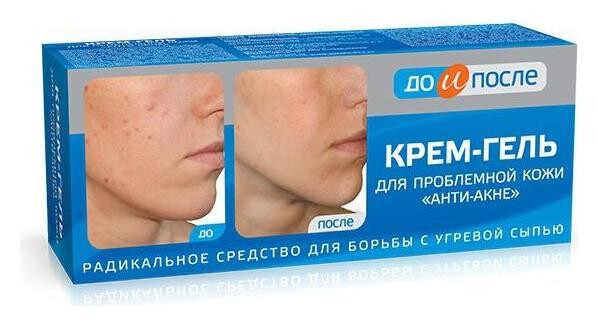 Крем-гель для проблемной кожи "До и после Анти-акне" отзывы