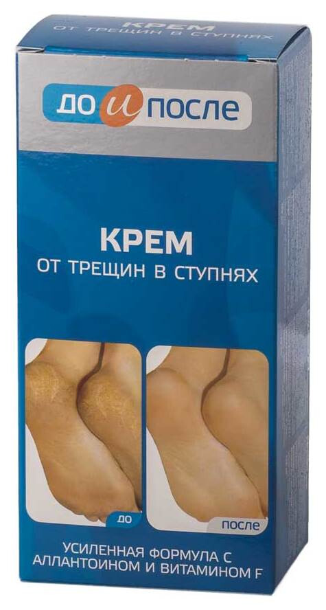 Крем от трещин в ступнях "До и после" отзывы