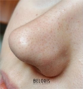 Отзыв на товар: ВВ крем-корректор для лица совершенствующий кожу SPF 15. Белита - Витэкс.